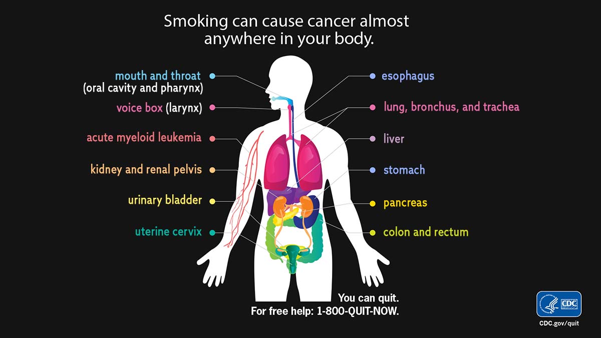 A graphic of the health effects of cancer. A black background with a human body and different parts that are affected by cancer.